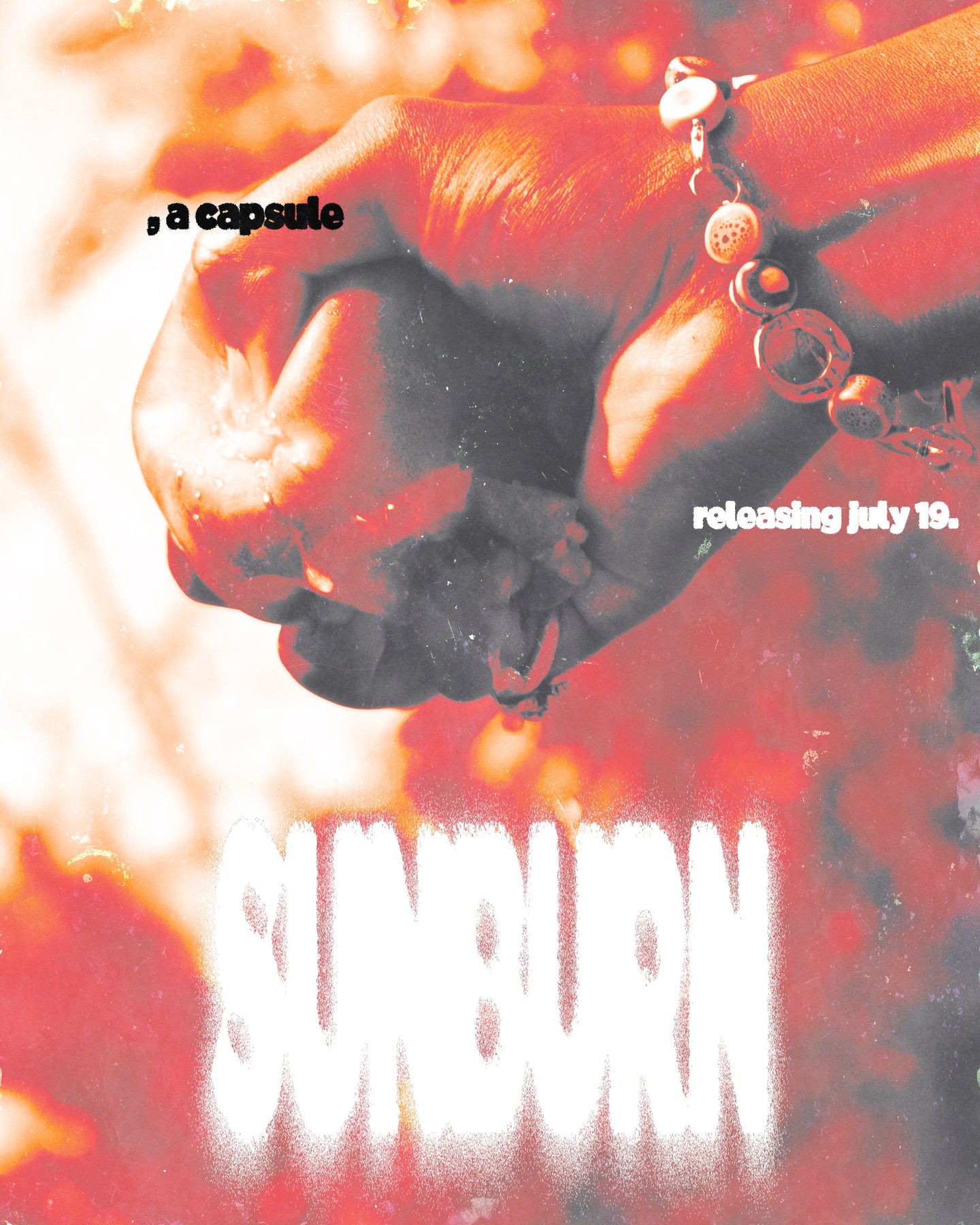 SUNBURN